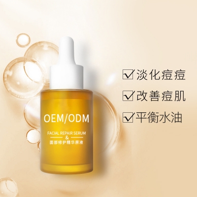 安顺市_祛痘精华原液OEM